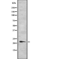 TPD52L1 Antibody - Western blot analysis of TPD52L1 using LOVO cells whole cells lysates