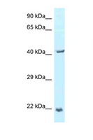 TPD52L2 / HD54 Antibody - TPD52L2 antibody Western blot of 721_B Cell lysate. Antibody concentration 1 ug/ml.  This image was taken for the unconjugated form of this product. Other forms have not been tested.