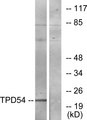 TPD52L2 / HD54 Antibody - Western blot analysis of lysates from Jurkat cells, using TPD54 Antibody. The lane on the right is blocked with the synthesized peptide.