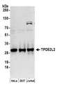 TPD52L2 / HD54 Antibody - Detection of human TPD52L2 by western blot. Samples: Whole cell lysate (50 µg) from HeLa, HEK293T, and Jurkat cells prepared using NETN lysis buffer. Antibodies: Affinity purified rabbit anti-TPD52L2 antibody used for WB at 0.4 µg/ml. Detection: Chemiluminescence with an exposure time of 3 minutes.