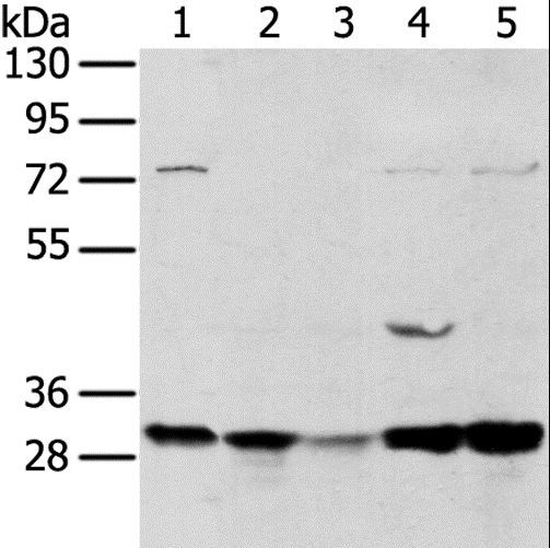 TPD52L2 / HD54 Antibody - Western blot analysis of 293T and MCF7 cell, mouse brain tissue and K562 cell, mouse bladder tissue, using TPD52L2 Polyclonal Antibody at dilution of 1:400.