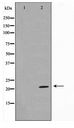 TPD52L2 / HD54 Antibody - Western blot of Jurkat cell lysate using TPD54 Antibody