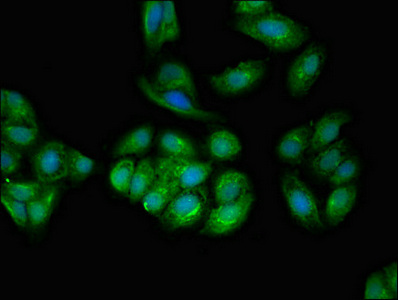 TPD52L2 / HD54 Antibody - Immunofluorescent analysis of HepG2 cells diluted at 1:100 and Alexa Fluor 488-congugated AffiniPure Goat Anti-Rabbit IgG(H+L)