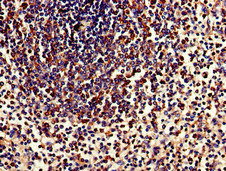 TPD52L2 / HD54 Antibody - Immunohistochemistry of paraffin-embedded human spleen tissue at dilution of 1:100