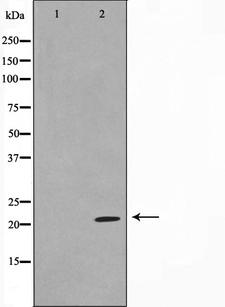 TPD52L2 / HD54 Antibody - Western blot analysis on Jurkat cell lysates using TPD54 antibody. The lane on the left is treated with the antigen-specific peptide.
