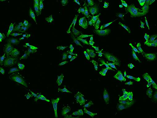 TPD52L2 / HD54 Antibody - Immunofluorescence staining of TPD52L2 in PC3 cells. Cells were fixed with 4% PFA, permeabilzed with 0.1% Triton X-100 in PBS, blocked with 10% serum, and incubated with rabbit anti-Human TPD52L2 polyclonal antibody (dilution ratio 1:200) at 4°C overnight. Then cells were stained with the Alexa Fluor 488-conjugated Goat Anti-rabbit IgG secondary antibody (green) and counterstained with DAPI (blue). Positive staining was localized to Cytoplasm.