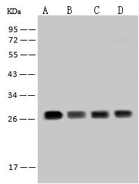 TPD52L2 / HD54 Antibody - Anti-TPD52L2 rabbit polyclonal antibody at 1:500 dilution. Lane A: HeLa Whole Cell Lysate. Lane B: 293T Whole Cell Lysate. Lane C: Jurkat Whole Cell Lysate. Lane D: U-251 MG Whole Cell Lysate. Lysates/proteins at 30 ug per lane. Secondary: Goat Anti-Rabbit IgG (H+L)/HRP at 1/10000 dilution. Developed using the ECL technique. Performed under reducing conditions. Predicted band size: 22 kDa. Observed band size: 28 kDa.