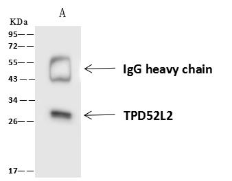 TPD52L2 / HD54 Antibody - TPD52L2 was immunoprecipitated using: Lane A: 0.5 mg HeLa Whole Cell Lysate. 4 uL anti-TPD52L2 rabbit polyclonal antibody and 60 ug of Immunomagnetic beads Protein A/G. Primary antibody: Anti-TPD52L2 rabbit polyclonal antibody, at 1:100 dilution. Secondary antibody: Goat Anti-Rabbit IgG (H+L)/HRP at 1/10000 dilution. Developed using the ECL technique. Performed under reducing conditions. Predicted band size: 22 kDa. Observed band size: 28 kDa.