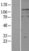 TPD52L2 / HD54 Protein - Western validation with an anti-DDK antibody * L: Control HEK293 lysate R: Over-expression lysate