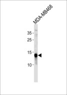 TPD52L3 Antibody - TPD52L3 Antibody western blot of MDA-MB468 cell line lysates (35 ug/lane). The TPD52L3 antibody detected the TPD52L3 protein (arrow).