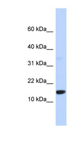 TPD52L3 Antibody - TPD52L3 antibody Western blot of 293T cell lysate. This image was taken for the unconjugated form of this product. Other forms have not been tested.