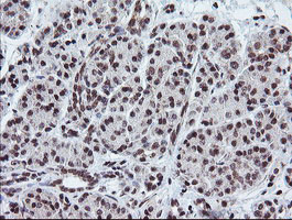 TPD52L3 Antibody - IHC of paraffin-embedded Human pancreas tissue using anti-TPD52L3 mouse monoclonal antibody. (Heat-induced epitope retrieval by 10mM citric buffer, pH6.0, 120°C for 3min).
