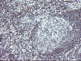 TPD52L3 Antibody - IHC of paraffin-embedded Human tonsil using anti-TPD52L3 mouse monoclonal antibody. (Heat-induced epitope retrieval by 10mM citric buffer, pH6.0, 120°C for 3min).