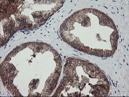 TPD52L3 Antibody - IHC of paraffin-embedded Human prostate tissue using anti-TPD52L3 mouse monoclonal antibody.