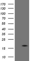 TPD52L3 Antibody - HEK293T cells were transfected with the pCMV6-ENTRY control (Left lane) or pCMV6-ENTRY TPD52L3 (Right lane) cDNA for 48 hrs and lysed. Equivalent amounts of cell lysates (5 ug per lane) were separated by SDS-PAGE and immunoblotted with anti-TPD52L3.