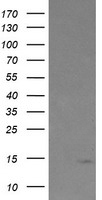 TPD52L3 Antibody - HEK293T cells were transfected with the pCMV6-ENTRY control (Left lane) or pCMV6-ENTRY TPD52L3 (Right lane) cDNA for 48 hrs and lysed. Equivalent amounts of cell lysates (5 ug per lane) were separated by SDS-PAGE and immunoblotted with anti-TPD52L3.