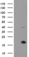 TPD52L3 Antibody - HEK293T cells were transfected with the pCMV6-ENTRY control (Left lane) or pCMV6-ENTRY TPD52L3 (Right lane) cDNA for 48 hrs and lysed. Equivalent amounts of cell lysates (5 ug per lane) were separated by SDS-PAGE and immunoblotted with anti-TPD52L3.