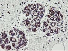 TPD52L3 Antibody - IHC of paraffin-embedded Human breast tissue using anti-TPD52L3 mouse monoclonal antibody.