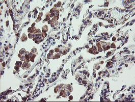 TPD52L3 Antibody - IHC of paraffin-embedded Human lung tissue using anti-TPD52L3 mouse monoclonal antibody.