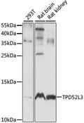 TPD52L3 Antibody - Western blot analysis of extracts of various cell lines, using TPD52L3 antibody at 1:1000 dilution. The secondary antibody used was an HRP Goat Anti-Rabbit IgG (H+L) at 1:10000 dilution. Lysates were loaded 25ug per lane and 3% nonfat dry milk in TBST was used for blocking. An ECL Kit was used for detection and the exposure time was 10S.