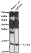 TPD52L3 Antibody - Western blot analysis of extracts of various cell lines, using TPD52L3 antibody at 1:1000 dilution. The secondary antibody used was an HRP Goat Anti-Rabbit IgG (H+L) at 1:10000 dilution. Lysates were loaded 25ug per lane and 3% nonfat dry milk in TBST was used for blocking. An ECL Kit was used for detection and the exposure time was 30S.