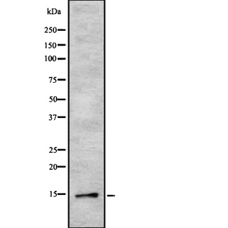TPD52L3 Antibody - Western blot analysis of TPD52L3 using HT29 whole cells lysates