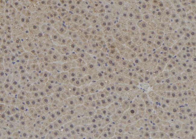 TPD52L3 Antibody - 1:100 staining rat liver tissue by IHC-P. The sample was formaldehyde fixed and a heat mediated antigen retrieval step in citrate buffer was performed. The sample was then blocked and incubated with the antibody for 1.5 hours at 22°C. An HRP conjugated goat anti-rabbit antibody was used as the secondary.