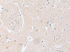 TPD52L3 Antibody - Immunohistochemistry of paraffin-embedded Human brain tissue  using TPD52L3 Polyclonal Antibody at dilution of 1:160(×200)