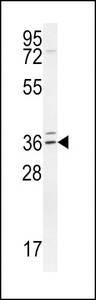 TPGS2 / C18orf10 Antibody - TPGS2 Antibody western blot of Jurkat cell line lysates (35 ug/lane). The TPGS2 antibody detected the TPGS2 protein (arrow).