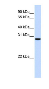 TPGS2 / C18orf10 Antibody - C18orf10 antibody Western blot of Fetal Muscle lysate. This image was taken for the unconjugated form of this product. Other forms have not been tested.