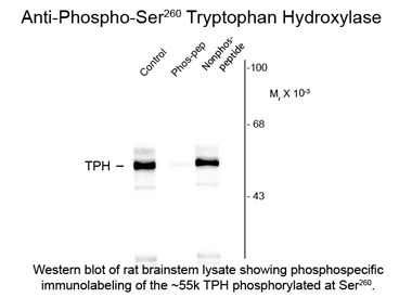 TPH / Tryptophan Hydroxylase Antibody