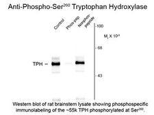 TPH / Tryptophan Hydroxylase Antibody