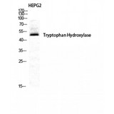 TPH1 / Tryptophan Hydroxylase Antibody - Western blot of TPH1 antibody
