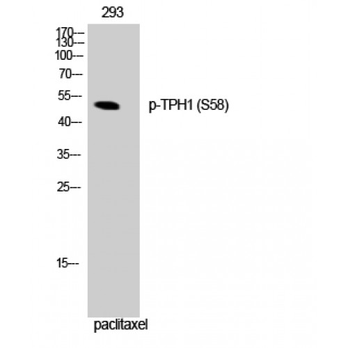 TPH1 / Tryptophan Hydroxylase Antibody - Western blot of Phospho-TPH1 (S58) antibody