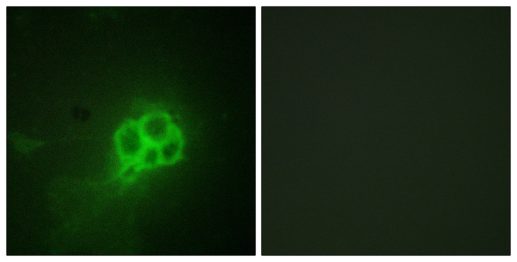 TPH1 / Tryptophan Hydroxylase Antibody - Immunofluorescence analysis of HUVEC cells, using Tryptophan Hydroxylase Antibody. The picture on the right is blocked with the synthesized peptide.