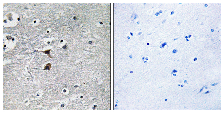 TPH1 / Tryptophan Hydroxylase Antibody - Immunohistochemistry analysis of paraffin-embedded human brain tissue, using Tryptophan Hydroxylase Antibody. The picture on the right is blocked with the synthesized peptide.