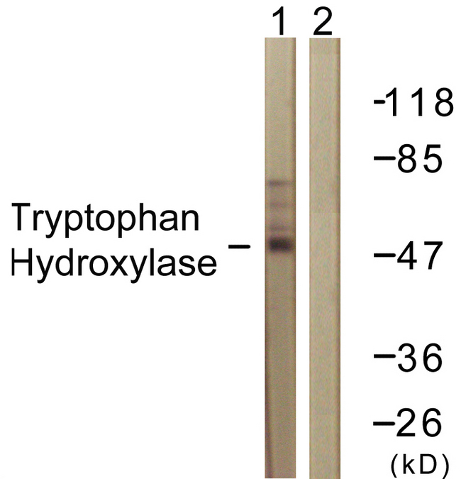 TPH1 / Tryptophan Hydroxylase Antibody - Western blot analysis of lysates from Jurkat cells, using Tryptophan Hydroxylase Antibody. The lane on the right is blocked with the synthesized peptide.