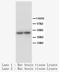TPH1 / Tryptophan Hydroxylase Antibody -  This image was taken for the unconjugated form of this product. Other forms have not been tested.