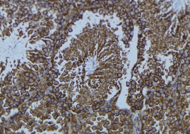 TPH1 / Tryptophan Hydroxylase Antibody - 1:100 staining mouse testis tissue by IHC-P. The sample was formaldehyde fixed and a heat mediated antigen retrieval step in citrate buffer was performed. The sample was then blocked and incubated with the antibody for 1.5 hours at 22°C. An HRP conjugated goat anti-rabbit antibody was used as the secondary.