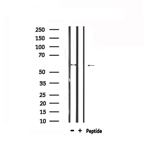 TPH1 / Tryptophan Hydroxylase Antibody - Western blot analysis of extracts of rat muscle using TPH1 antibody.