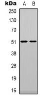 TPH1 / Tryptophan Hydroxylase Antibody - Western blot analysis of TPH1 expression in Jurkat (A); HepG2 (B) whole cell lysates.