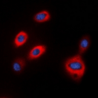 TPH1 / Tryptophan Hydroxylase Antibody - Immunofluorescent analysis of TPH1 staining in HepG2 cells. Formalin-fixed cells were permeabilized with 0.1% Triton X-100 in TBS for 5-10 minutes and blocked with 3% BSA-PBS for 30 minutes at room temperature. Cells were probed with the primary antibody in 3% BSA-PBS and incubated overnight at 4 deg C in a humidified chamber. Cells were washed with PBST and incubated with a DyLight 594-conjugated secondary antibody (red) in PBS at room temperature in the dark. DAPI was used to stain the cell nuclei (blue).