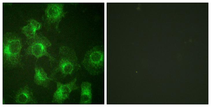 TPH1 / Tryptophan Hydroxylase Antibody - Peptide - + Immunofluorescence analysis of HeLa cells, using Tryptophan Hydroxylase (Ab-260) antibody.
