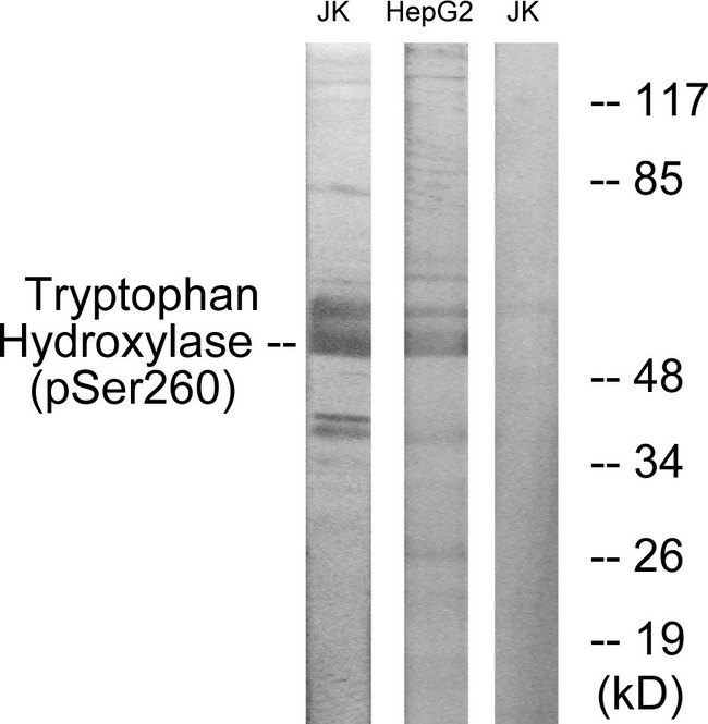 TPH1 / Tryptophan Hydroxylase Antibody - Western blot analysis of lysates from Jurkat cells and HepG2 cells, using Tryptophan Hydroxylase (Phospho-Ser260) Antibody. The lane on the right is blocked with the phospho peptide.