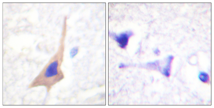 TPH1 / Tryptophan Hydroxylase Antibody - Immunohistochemistry analysis of paraffin-embedded human brain, using Tryptophan Hydroxylase (Phospho-Ser58) Antibody. The picture on the right is blocked with the phospho peptide.