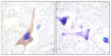 TPH1 / Tryptophan Hydroxylase Antibody - Immunohistochemistry analysis of paraffin-embedded human brain, using Tryptophan Hydroxylase (Phospho-Ser58) Antibody. The picture on the right is blocked with the phospho peptide.