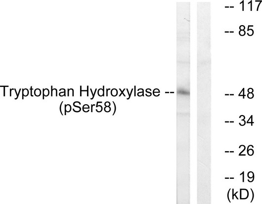 TPH1 / Tryptophan Hydroxylase Antibody - Western blot analysis of lysates from 293 cells treated with paclitaxel 1uM 24h, using Tryptophan Hydroxylase (Phospho-Ser58) Antibody. The lane on the right is blocked with the phospho peptide.