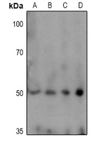 TPH1 / Tryptophan Hydroxylase Antibody - Western blot analysis of TPH1 (pS58) expression in HEK293T (A), THP1 (B), MCF7 (C), SGC7901 (D) whole cell lysates.