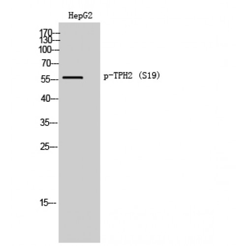 TPH2 Antibody - Western blot of Phospho-TPH2 (S19) antibody