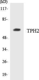 TPH2 Antibody - Western blot analysis of the lysates from HUVECcells using TPH2 antibody.
